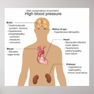 Huvudkomplikationer av högtrycksdiagram för blodtr poster