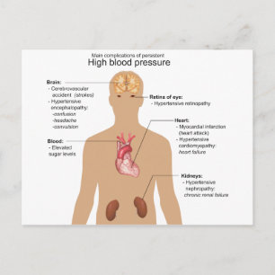 Huvudkomplikationer av högtrycksdiagram för blodtr vykort