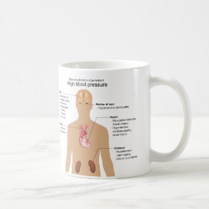 Huvudsakliga komplikationer av kickblodtryck kaffemugg