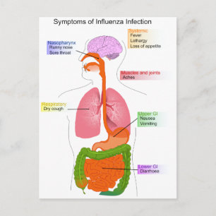 Huvudsymtom på ett influensainfektionsdiagram vykort