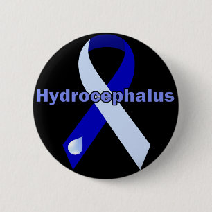 Hydrocephalusen knäppas knapp