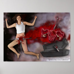 Hysterectomyen Poster