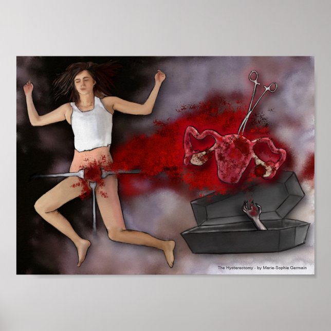 Hysterektomi Poster (Framsidan)