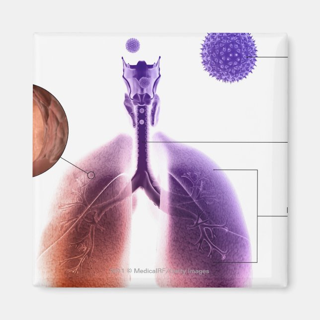 Illustration av en astmaattack från pollen magnet (Framsidan)