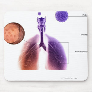 Illustration av en astmaattack från pollen musmatta