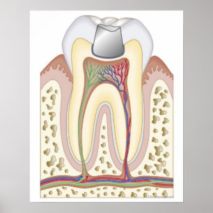 Illustration av tand- fyllning poster