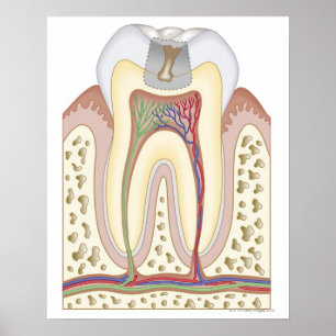 Illustration av tandförfall poster
