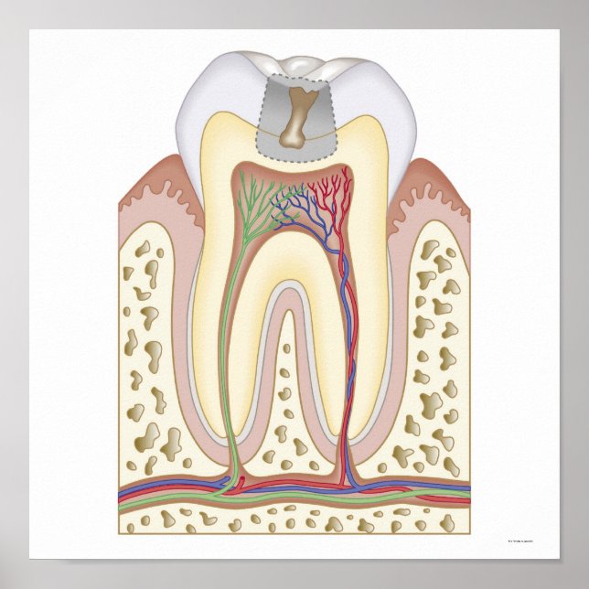 Illustration av tandförfall poster (Framsidan)