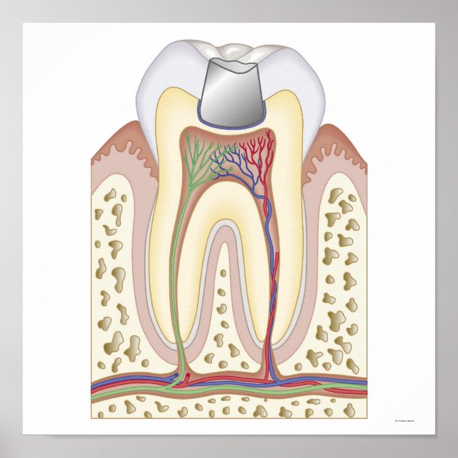 Illustration av tandfyllning poster (Framsidan)