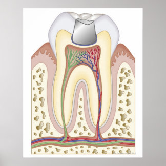 Illustration av tandfyllning poster