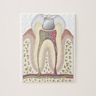 Illustration av tandfyllning pussel