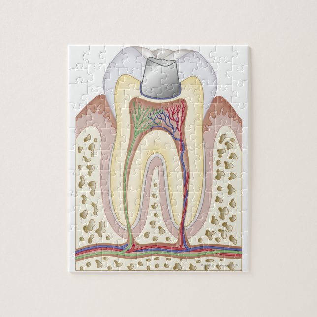 Illustration av tandfyllning pussel (Vertikal)