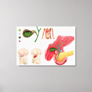 Illustration som visar cholecystectomyen canvastryck