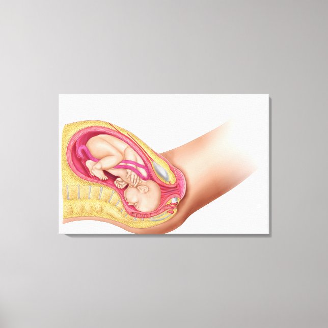 Illustration som visar leverans av Fetus 2 Canvastryck (Framsida)