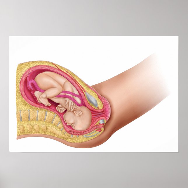 Illustration som visar leverans av Fetus 2 Poster (Framsidan)