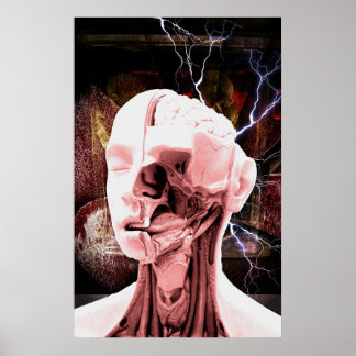 inåtvänd poster