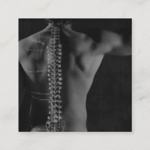 Inbindningsteckningen överdrar fotoChiropractic Fyrkantigt Visitkort