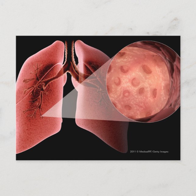 Inflammad luftväg under en astmaattack vykort (Framsida)
