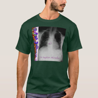 Inga viktiga Abnormalities Tee