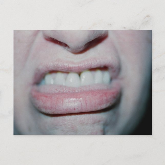 Inget leende idag vykort (Framsida)