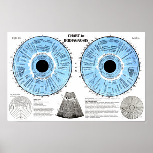 Iridiagnos Iridologi Ögon Diagram Poster