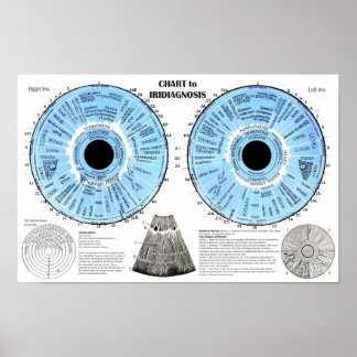Iridiagnos Iridologi Ögon Diagram Poster