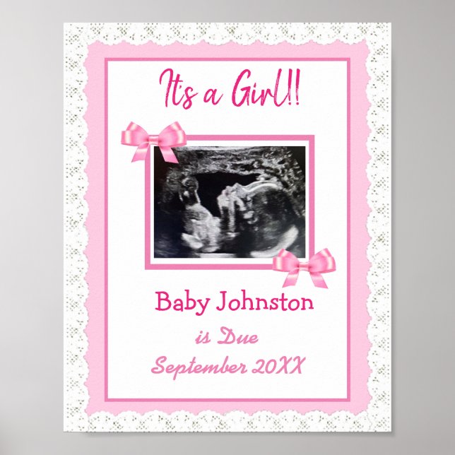 It's a Girl, Pregnancy Announcement Ultrasound Pic Poster (Framsidan)