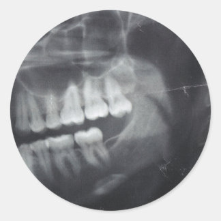 Jaw Stickers Runt Klistermärke