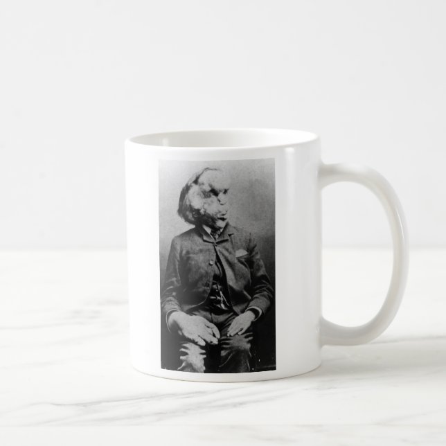 Joseph "John" Merrick elefantmanen från 1889 Kaffemugg (Höger)