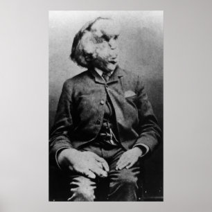Joseph "John" Merrick elefantmanen från 1889 Poster