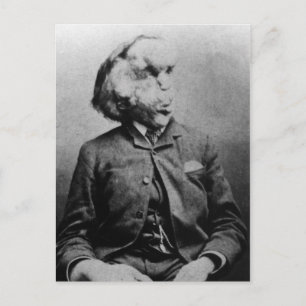 Joseph "John" Merrick Elefantmannen från 1889 Vykort