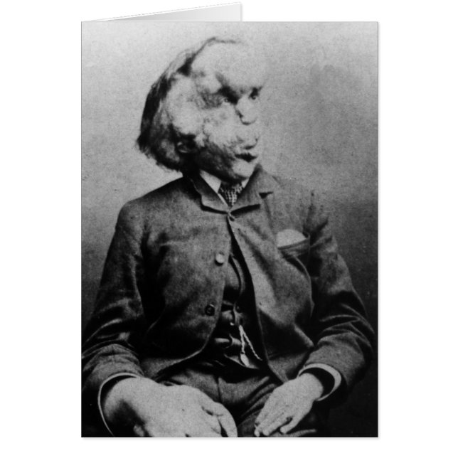 Joseph "John" Merrick The Elephant Man från 1889 Hälsningskort (Framsidan)