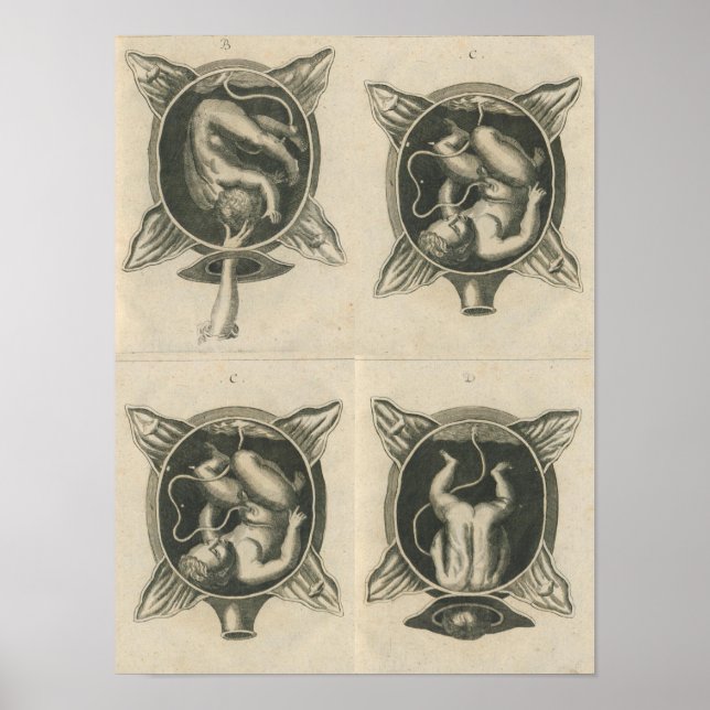 Justine Siegemund Court Midfru Baby Birth Delevert Poster (Framsidan)