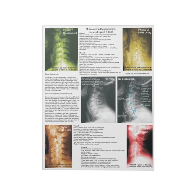 Kervik degenerering av tjärp-sladdning anteckningsblock (Roterad)