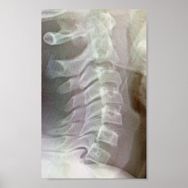 Kerviskt ryggradsdjur Tie Poster (Framsidan)