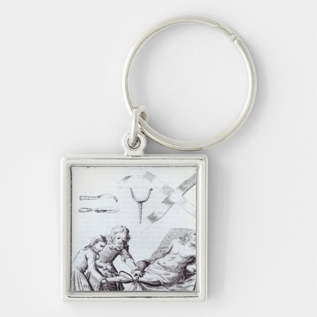 Kirurgisk funktion som amputerar en lägga benen på fyrkantig silverfärgad nyckelring (Framsidan)