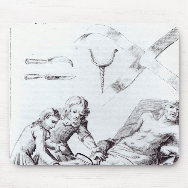 Kirurgisk funktion som amputerar en lägga benen på musmatta (Framsidan)