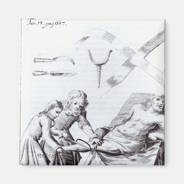 Kirurgiska ingrepp för att amputera ett ben magnet (Framsidan)