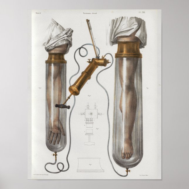 Kirurgiska medicinska instrument Vintage Anatomi S Poster (Framsidan)