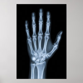 Klinisk röntgenhand poster