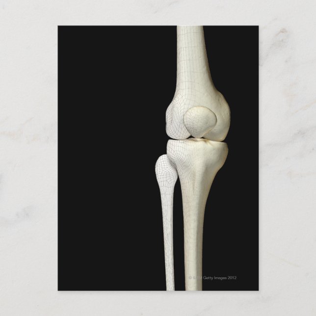 Knäens ben 4 vykort (Framsida)