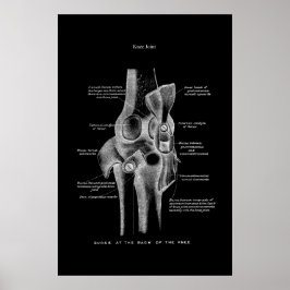 Knäsblödning i kroppens medicinska muskelvägg poster