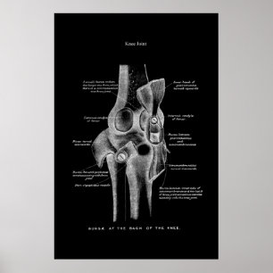Knäsblödning i kroppens medicinska muskelvägg poster