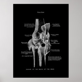 Knee Joints Anatomy Art Poster