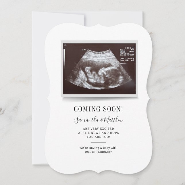 Kommer snart att få Ultrasound Baby Gender-vykort Inbjudningar (Framsida)
