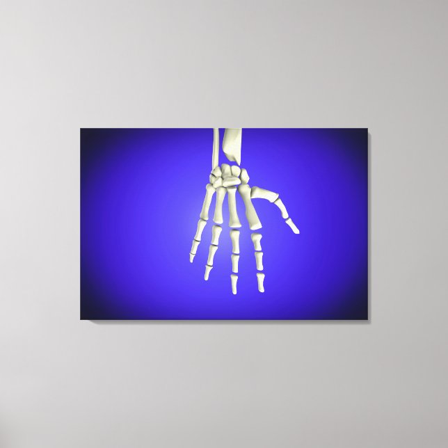 Konceptuell bild av benen i människan Hand 2 (Framsida)