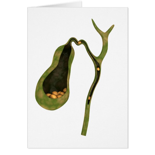 Konceptuell bild av gallsten inuti gallret hälsningskort (Framsidan)