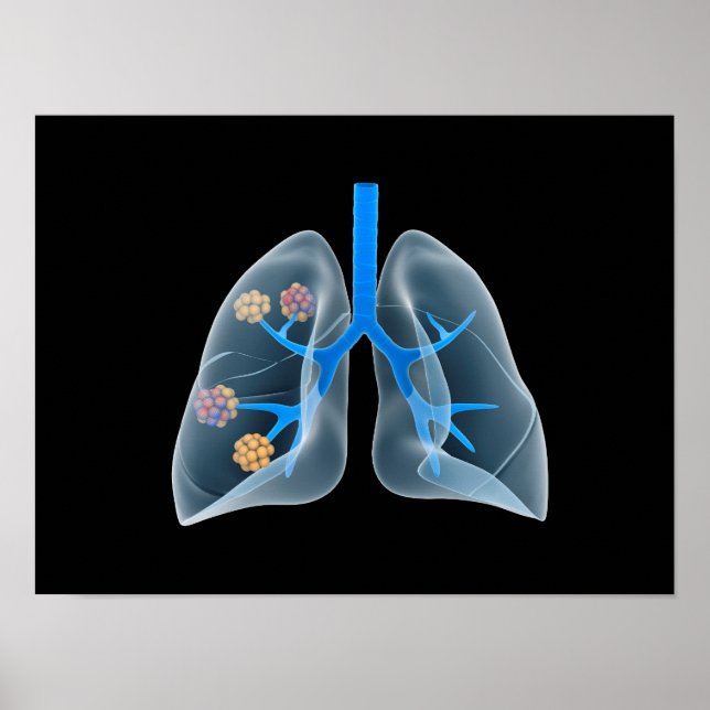 Konceptuell bild av humant hjärta 4 poster (Framsidan)