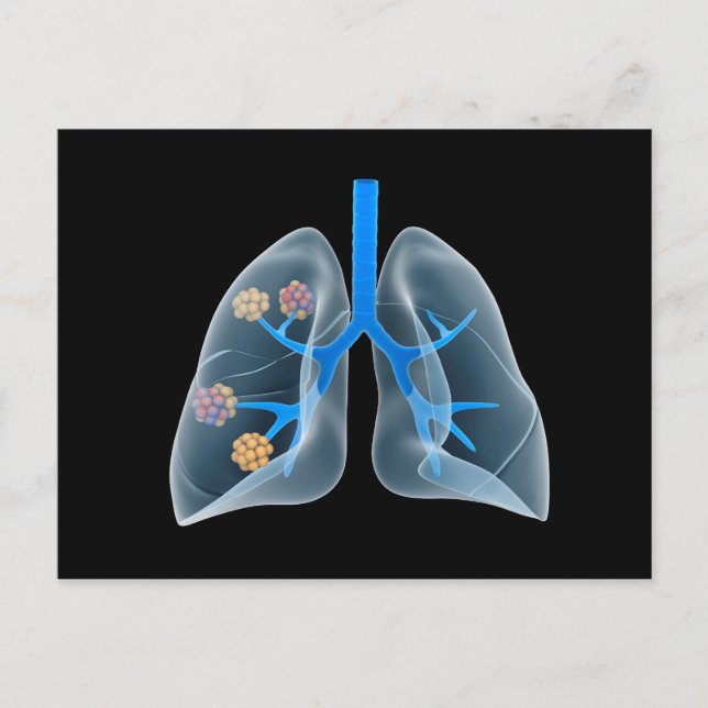 Konceptuell bild av humant hjärta 4 vykort (Framsida)