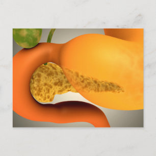 Konceptuell bild av humant pankreas och stomach vykort